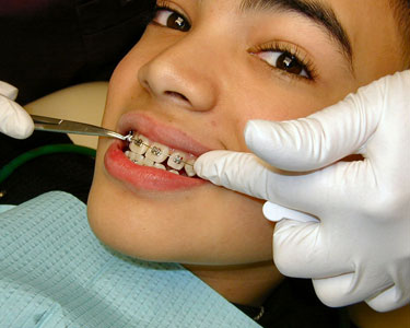 Kids Travis County and Williamson County: Orthodontists - Fun 4 Austin Kids