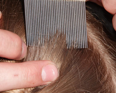 Kids Travis County and Williamson County: Lice Treatment - Fun 4 Austin Kids